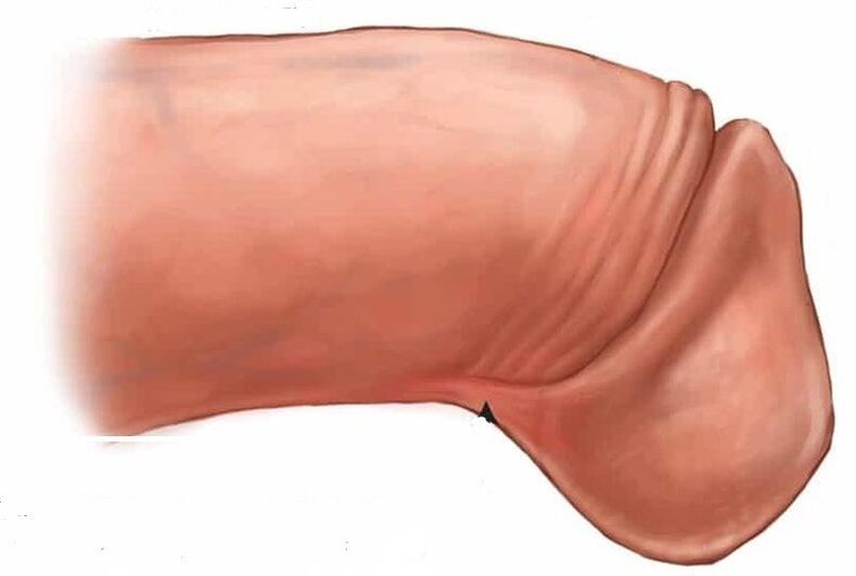 comment agrandir le gland