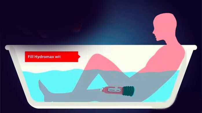 Agrandissement du pénis avec pompe à eau
